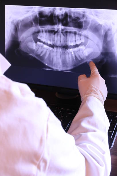Best Emergency Tooth Extraction in Sherwood Manor, CT
